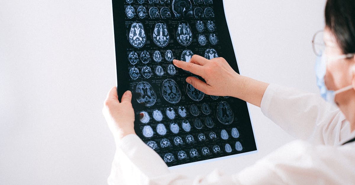 What are neurological symptoms you shouldn't ignore?