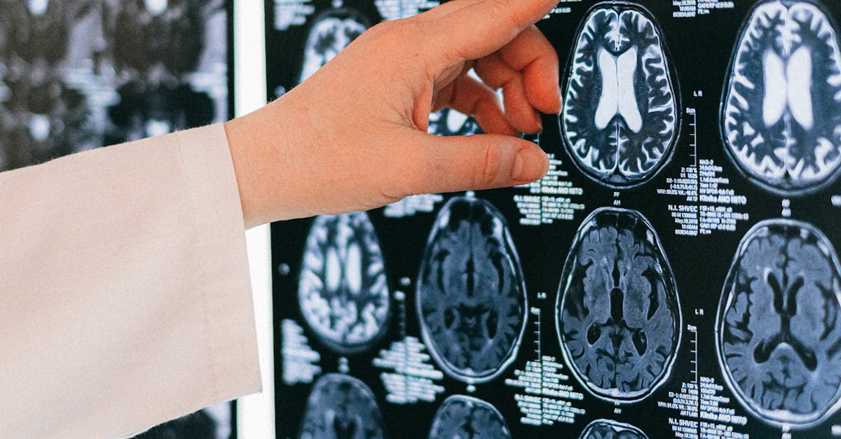 What is the most common neurological disorder?